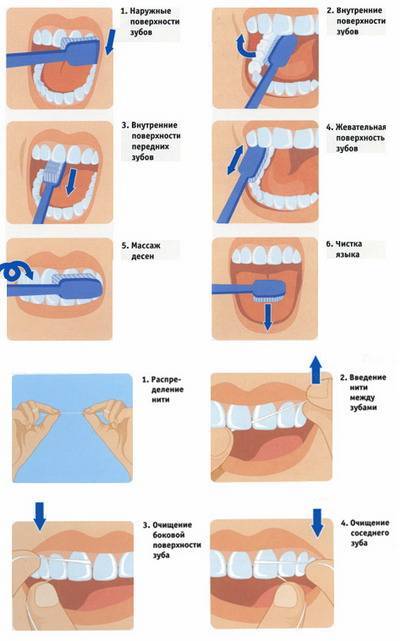 Гигиеническая чистка зубов: виды, этапы, результат