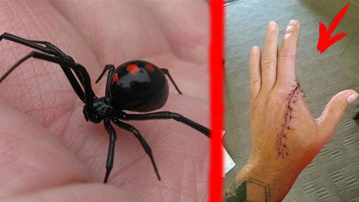 Опасен ли укус южнорусского тарантула для человека, действия при укусе