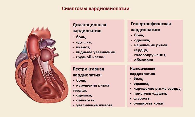 Симптомы и лечение кардиомиопатии у кошек в нижнем новгороде