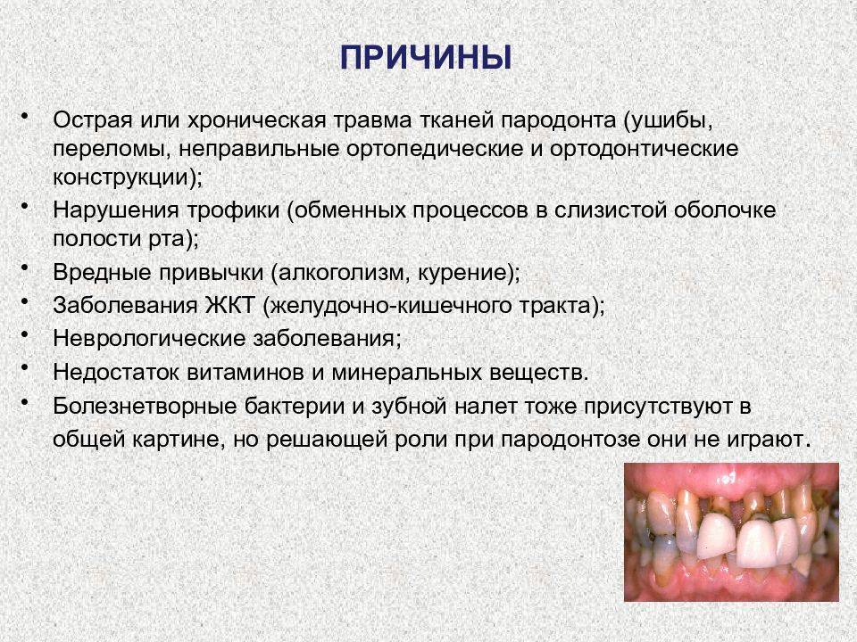 Симптомы и методы лечения болезней зубов у кошек