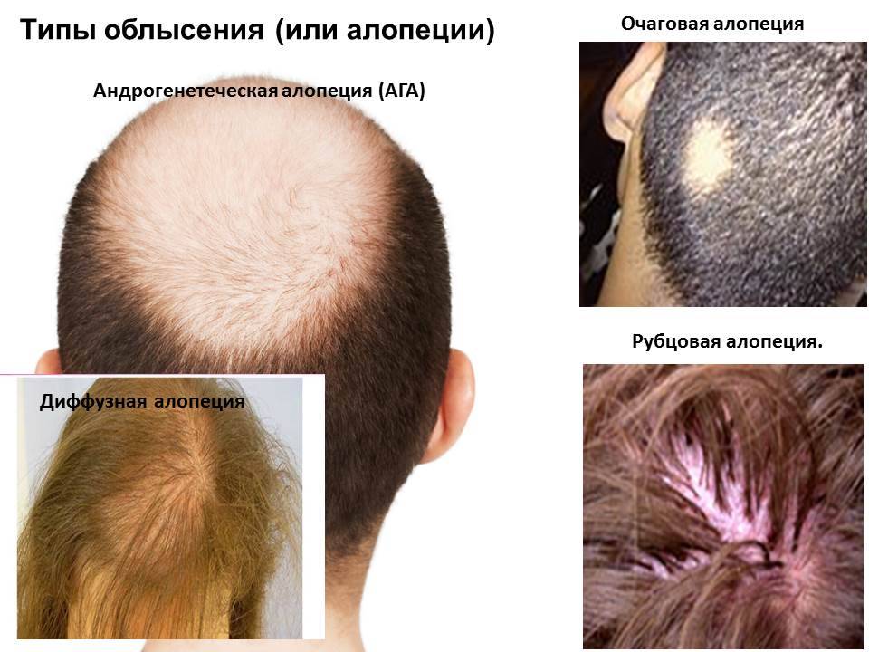 Кот лысеет: проплешины, выпадает шерсть на голове
