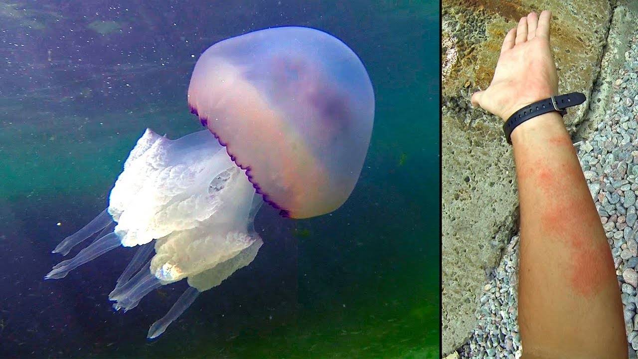 Самые опасные медузы в мире и где они обитают :: инфониак