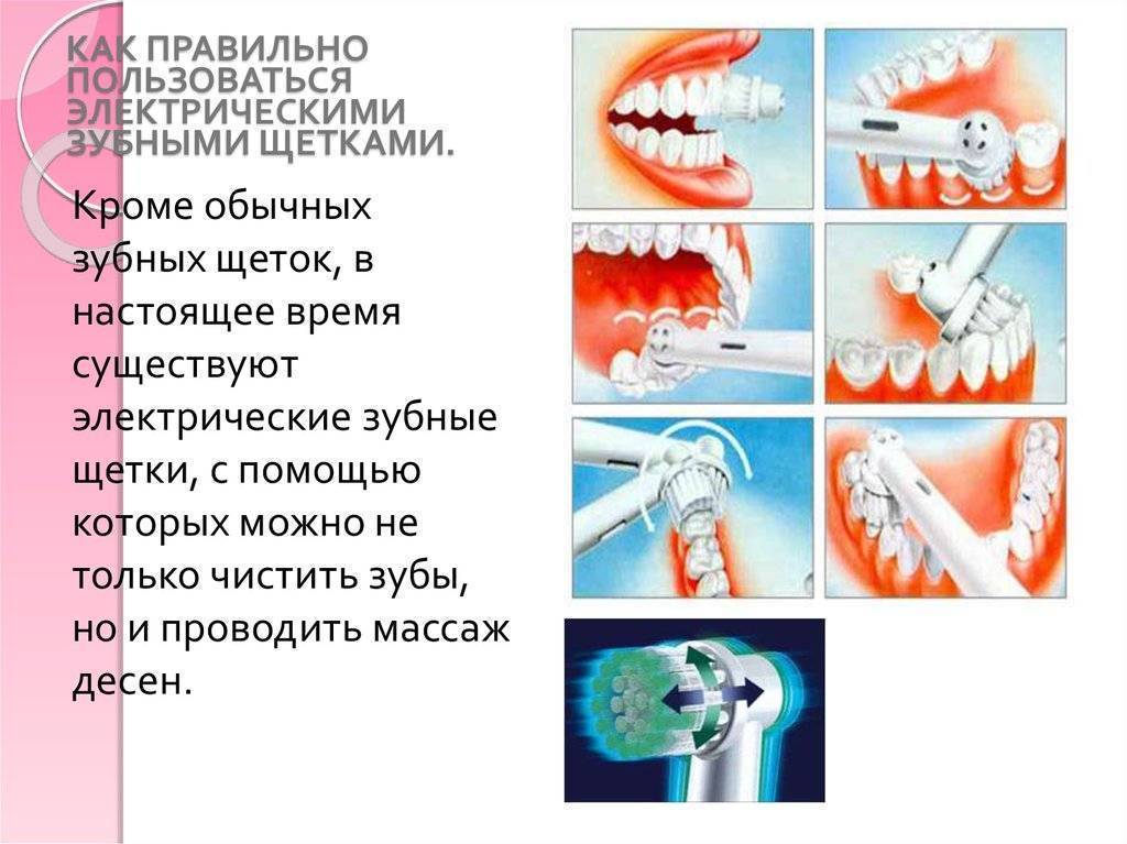Как правильно чистить зубы: инструкция и советы