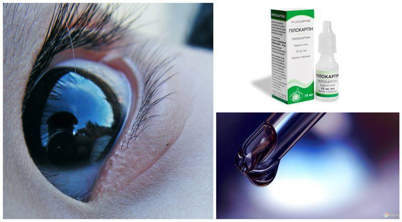 Травмы глаза – лечение и симптомы при кровоизлияниях, ранениях роговицы и других повреждениях