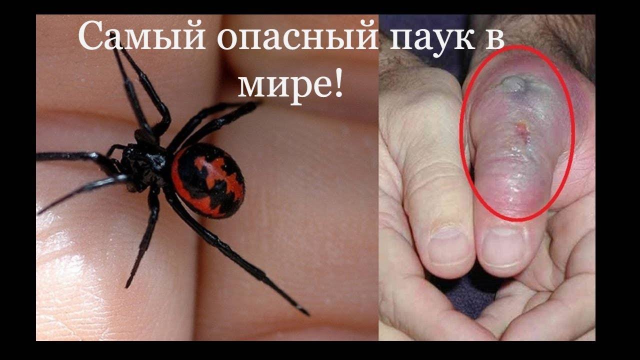 Чем опасен укус паука тарантула (птицееда) для человека