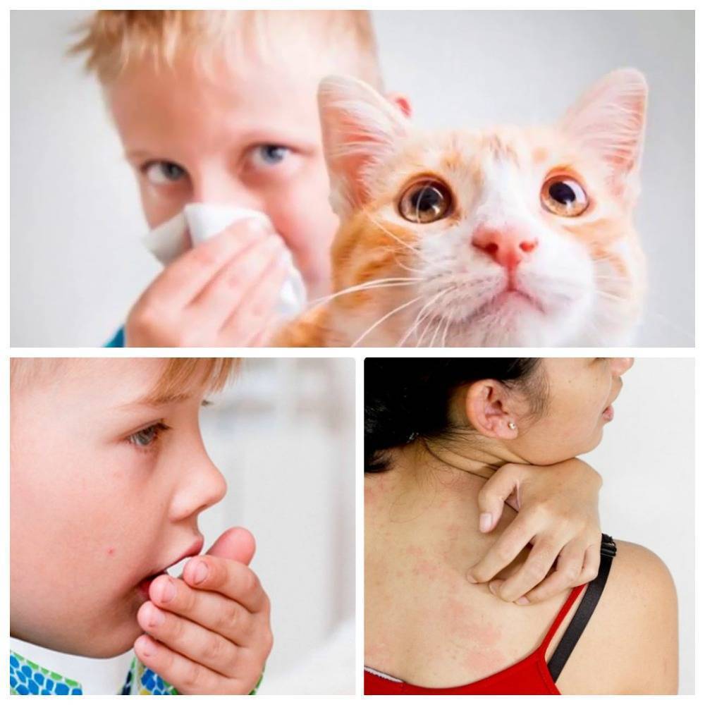 Аллергия у человека на кошек фото