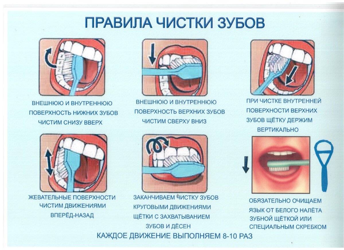 Как ухаживать за зубами питомца