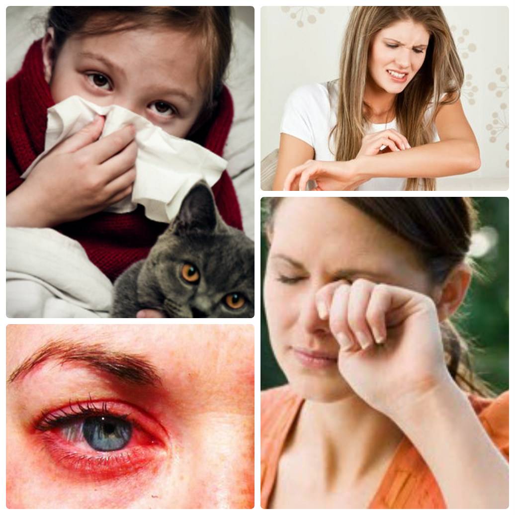 Как проявляется аллергия на кошек? как ее лечить?