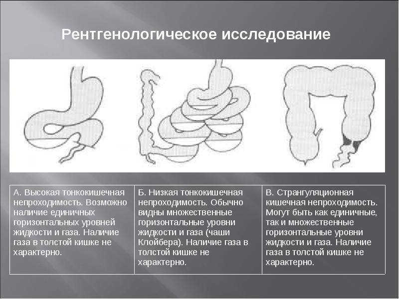 Непроходимость кишечника у кошек и котов - чем опасна и что нужно знать! | caticat.ru